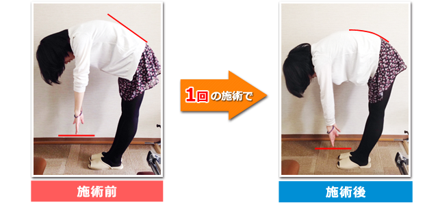 当院の施術を受けた方のビフォーアフター