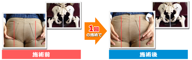 当院の施術を受けた方のビフォーアフター