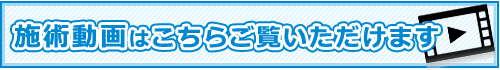 施術動画をこちらからご覧いただけます。